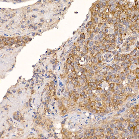 ERp19 Rabbit mAb