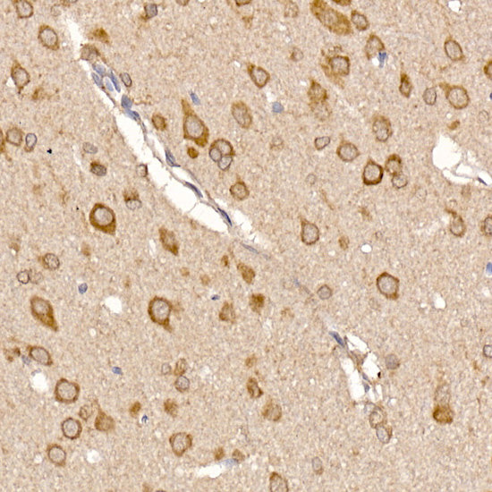 ERp19 Rabbit mAb