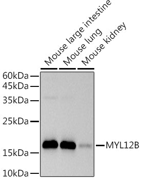 MYL12B Rabbit mAb