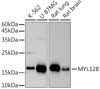 MYL12B Rabbit mAb