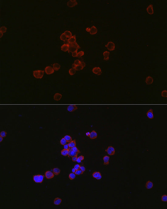 MYL12B Rabbit mAb