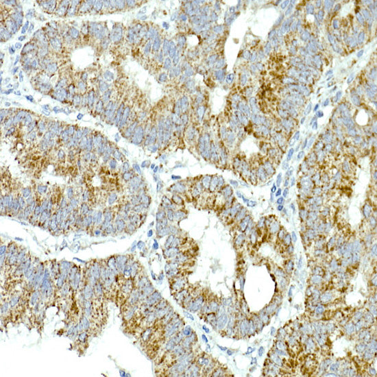 MRPS15 Rabbit mAb