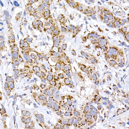 MRPS15 Rabbit mAb