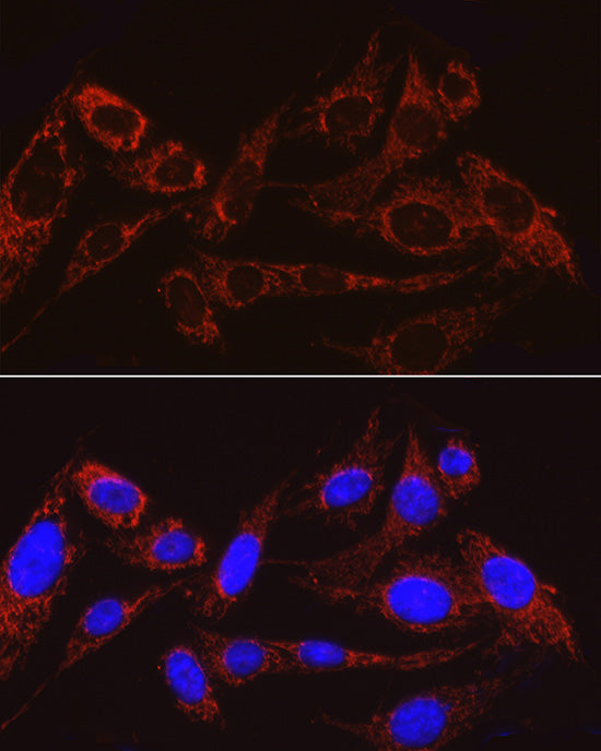 MRPS15 Rabbit mAb