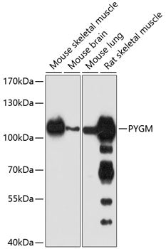 PYGM Rabbit pAb