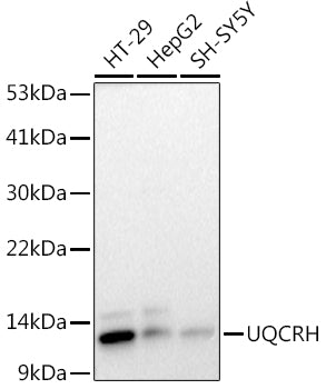 UQCRH Rabbit mAb