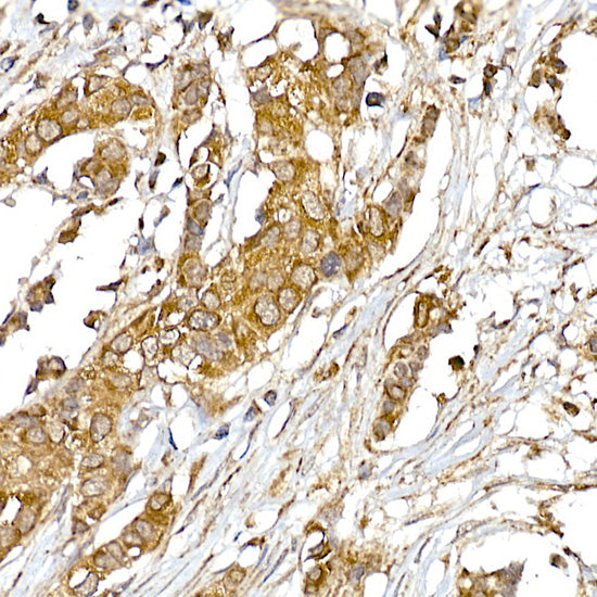 UQCRH Rabbit mAb