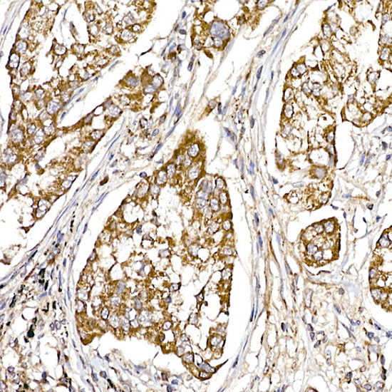 UQCRH Rabbit mAb