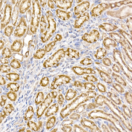 UQCRH Rabbit mAb