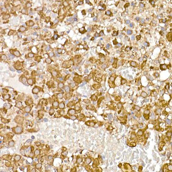 UQCRH Rabbit mAb