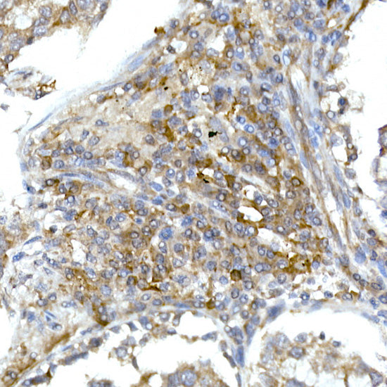RPL13 Rabbit mAb