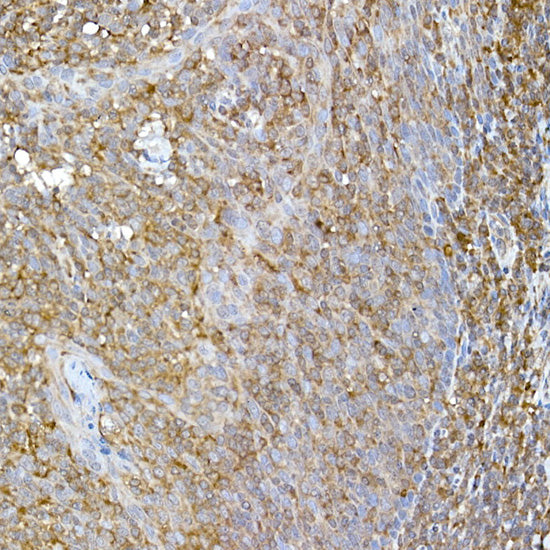 RPL13 Rabbit mAb