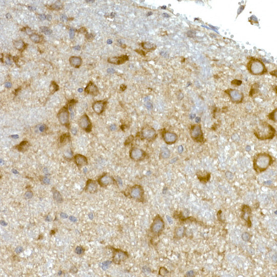RPL13 Rabbit mAb