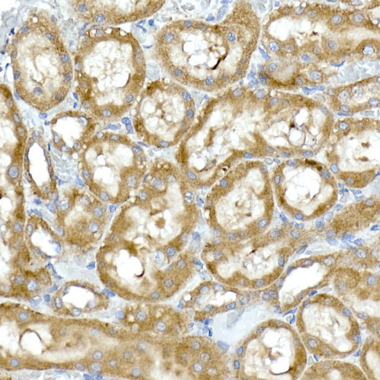 RPL13 Rabbit mAb