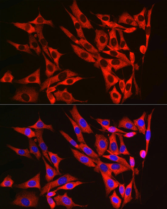 RPL13 Rabbit mAb