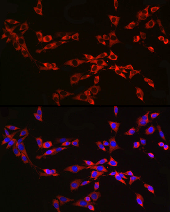 RPL13 Rabbit mAb
