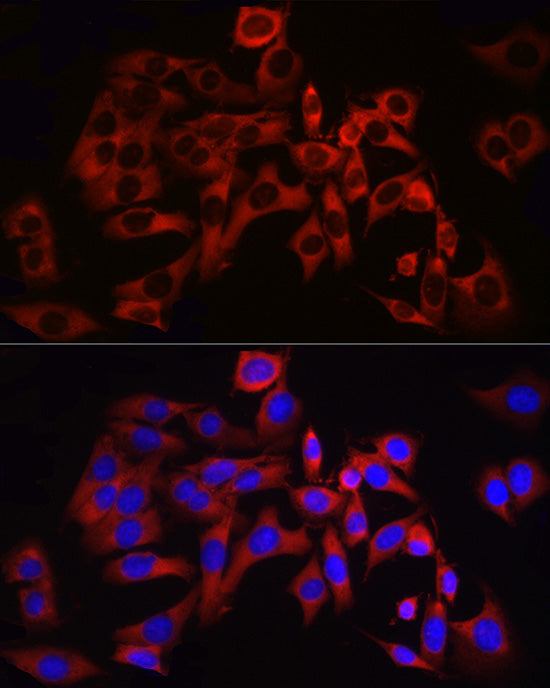 RPL13 Rabbit mAb