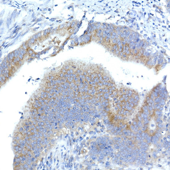 Syntaxin 16 Rabbit mAb