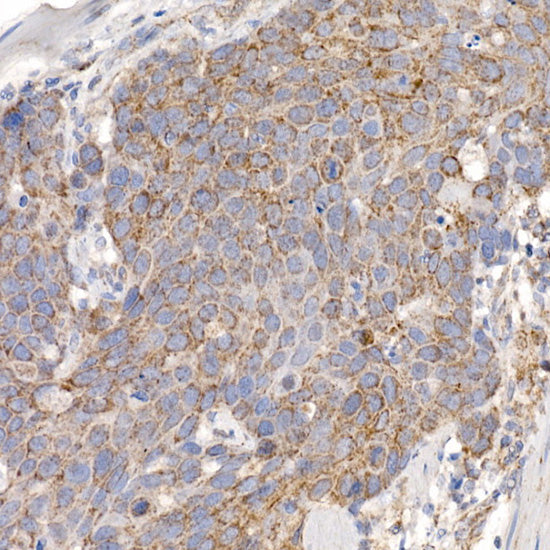MMUT Rabbit mAb