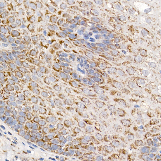 MMUT Rabbit mAb
