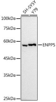 ENPP5 Rabbit mAb