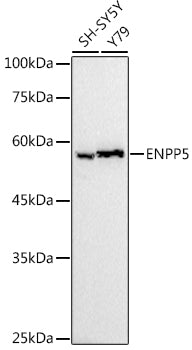 ENPP5 Rabbit mAb