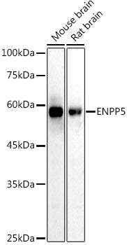ENPP5 Rabbit mAb