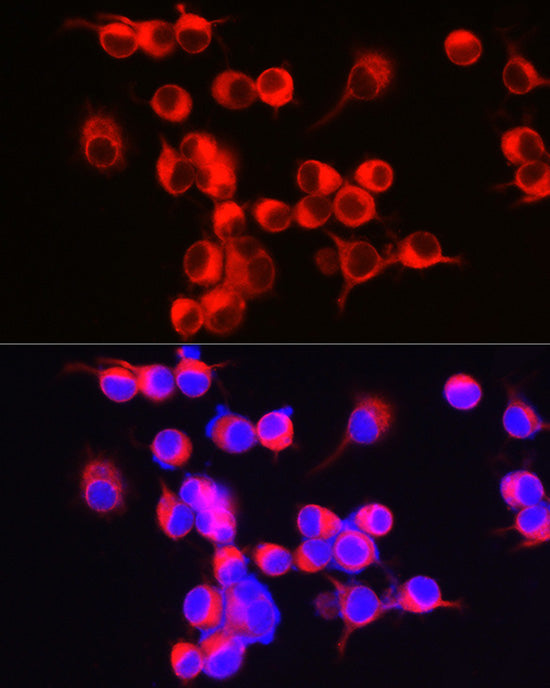 ENPP5 Rabbit mAb
