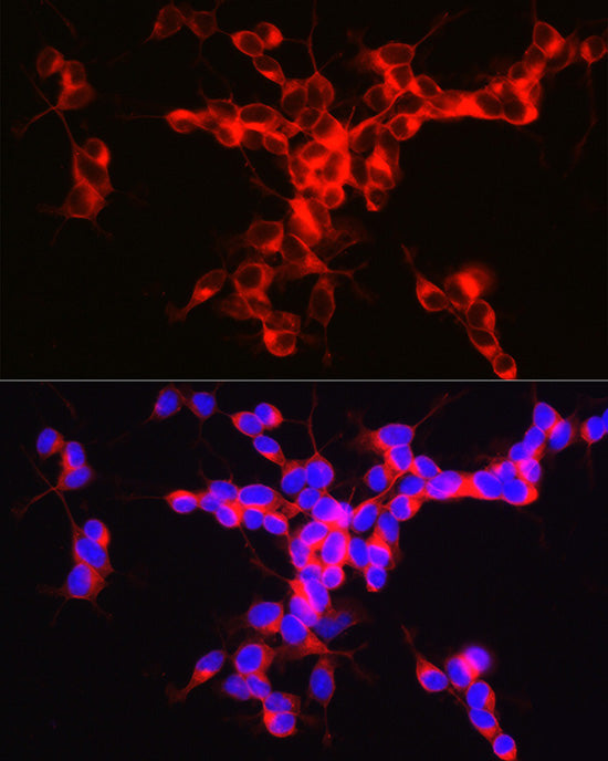 ENPP5 Rabbit mAb