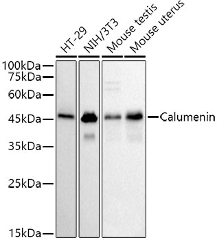 Calumenin Rabbit mAb