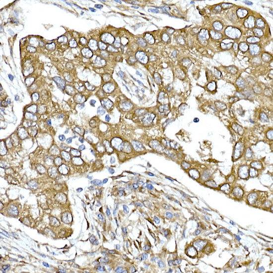 Calumenin Rabbit mAb