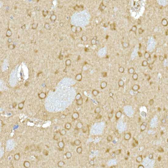 Calumenin Rabbit mAb