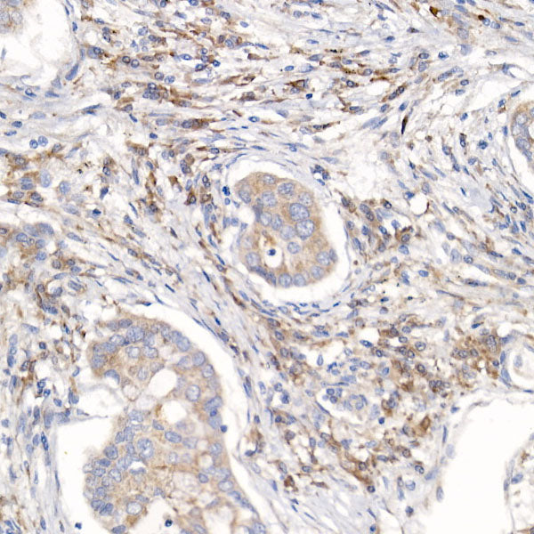 RPL26L1 Rabbit mAb