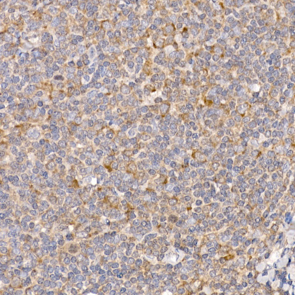 RPL26L1 Rabbit mAb
