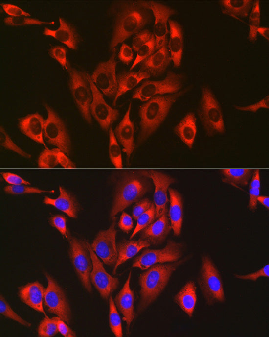 RPL26L1 Rabbit mAb