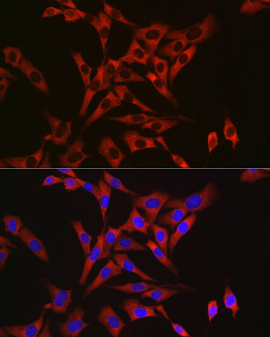 RPL26L1 Rabbit mAb