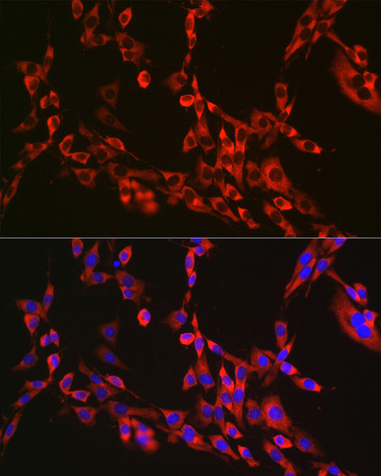 RPL26L1 Rabbit mAb