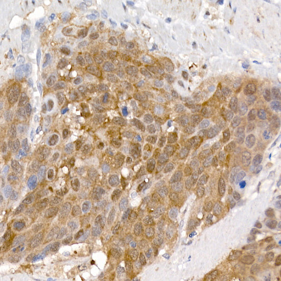 PCBD1 Rabbit mAb