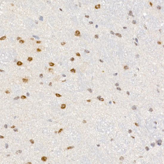 PCBD1 Rabbit mAb
