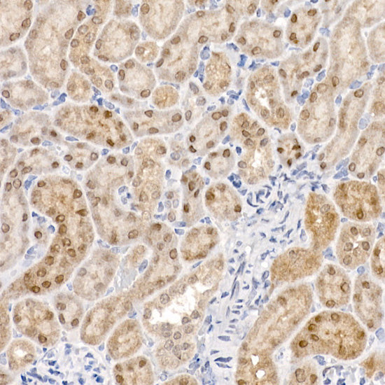 PCBD1 Rabbit mAb