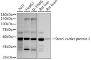Sterol carrier protein 2 Rabbit mAb