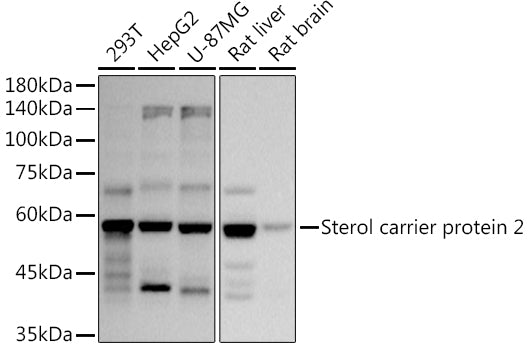 Sterol carrier protein 2 Rabbit mAb
