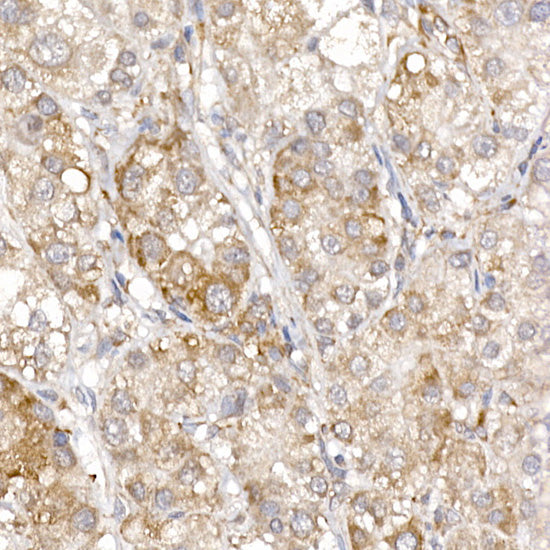 Sterol carrier protein 2 Rabbit mAb