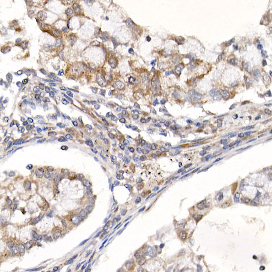 Sterol carrier protein 2 Rabbit mAb