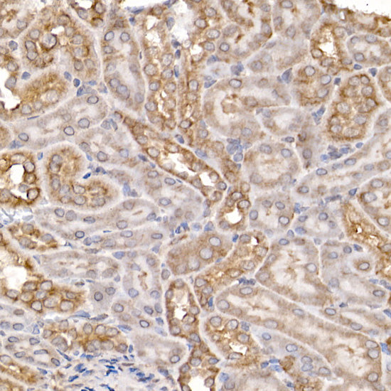 Sterol carrier protein 2 Rabbit mAb