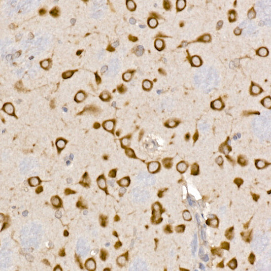 Sterol carrier protein 2 Rabbit mAb