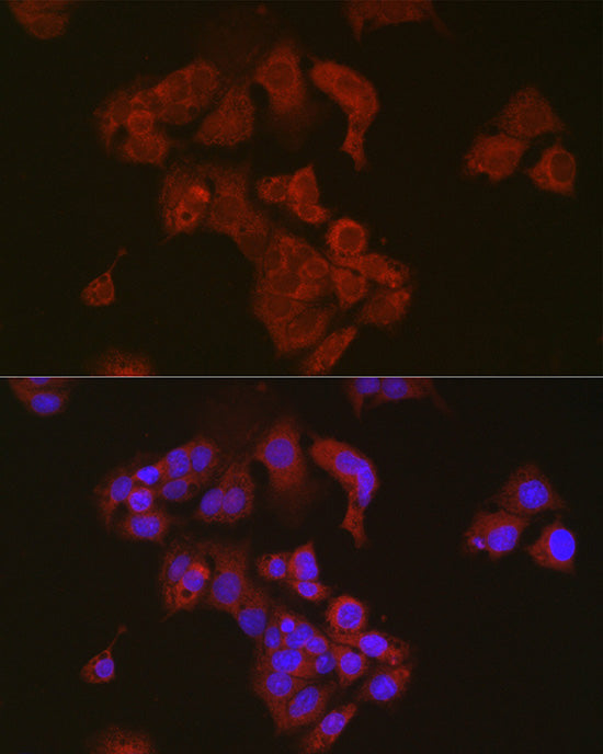 Sterol carrier protein 2 Rabbit mAb