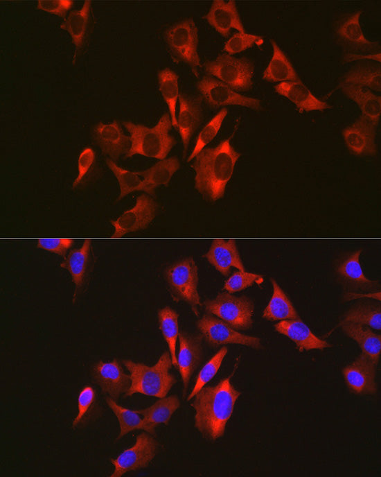 Sterol carrier protein 2 Rabbit mAb