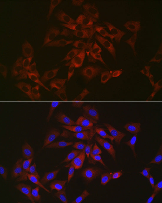 Sterol carrier protein 2 Rabbit mAb