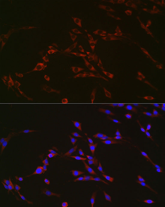 Sterol carrier protein 2 Rabbit mAb
